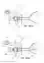 Fig. 97 - Methods and systems for performing a medical procedure
