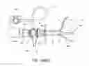 Fig. 98 - Methods and systems for performing a medical procedure