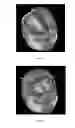 Fig. 06 - BRAIN VOLUMETRIC MEASURING METHOD AND SYSTEM USING THE SAME