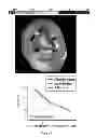 Fig. 07 - BRAIN VOLUMETRIC MEASURING METHOD AND SYSTEM USING THE SAME