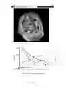 Fig. 08 - BRAIN VOLUMETRIC MEASURING METHOD AND SYSTEM USING THE SAME