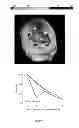 Fig. 09 - BRAIN VOLUMETRIC MEASURING METHOD AND SYSTEM USING THE SAME
