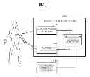 Fig. 02 - Method and apparatus for tracking a position of a tumor