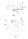 Fig. 08 - Microwave ablation catheter and method of utilizing the same