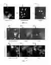 Fig. 06 - ACOUSTICALLY RESPONSIVE PARTICLES WITH DECREASED CAVITATION THRESHOLD