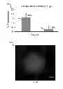 Fig. 07 - ACOUSTICALLY RESPONSIVE PARTICLES WITH DECREASED CAVITATION THRESHOLD