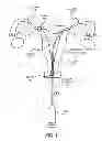 Fig. 02 - METHODS AND DEVICES FOR DETERMINING LUMEN OCCLUSION
