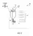 Fig. 07 - METHODS AND DEVICES FOR DETERMINING LUMEN OCCLUSION