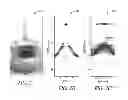 Fig. 08 - Bone surface image reconstruction using ultrasound