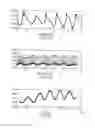 Fig. 04 - Apparatus and method for estimating stroke volume of the heart using bio-impedance techniques