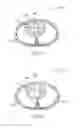 Fig. 08 - Apparatus and method for estimating stroke volume of the heart using bio-impedance techniques