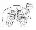 Fig. 01 - Robust rate calculation in an implantable cardiac stimulus or monitoring device