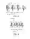Fig. 03 - Robust rate calculation in an implantable cardiac stimulus or monitoring device