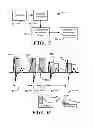Fig. 04 - Robust rate calculation in an implantable cardiac stimulus or monitoring device