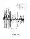 Fig. 10 - Robust rate calculation in an implantable cardiac stimulus or monitoring device