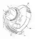 Fig. 01 - Field of view matching in a visual prosthesis