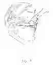 Fig. 02 - Field of view matching in a visual prosthesis