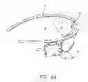 Fig. 06 - Field of view matching in a visual prosthesis