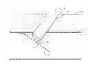 Fig. 01 - Vascular locator device and method for locating a vessel
