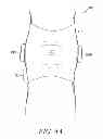 Fig. 05 - BRACE TO PROVIDE HOT AND COLD THERAPY
