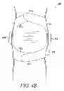 Fig. 06 - BRACE TO PROVIDE HOT AND COLD THERAPY