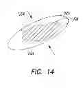 Fig. 13 - BRACE TO PROVIDE HOT AND COLD THERAPY