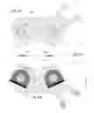 Fig. 28 - BRACE TO PROVIDE HOT AND COLD THERAPY