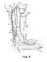 Fig. 07 - Ankle walker