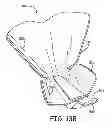 Fig. 22 - Ankle walker