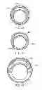 Fig. 06 - Apparatus and methods for clot disruption and evacuation