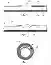 Fig. 08 - Apparatus and methods for clot disruption and evacuation