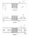 Fig. 09 - Apparatus and methods for clot disruption and evacuation