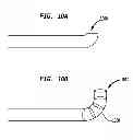 Fig. 09 - PERCUTANEOUS TRANSPEDICULAR ENDOVERTEBRAL DEVICE