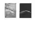 Fig. 09 - Device for efficient delivery of compounds to or through the skin or biological barriers, using light-absorbing thin films