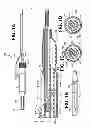 Fig. 02 - Methods and devices for eluting agents to a vessel