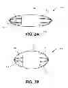 Fig. 04 - Methods and devices for eluting agents to a vessel