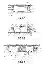 Fig. 07 - Methods and devices for eluting agents to a vessel