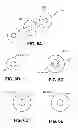 Fig. 08 - Methods and devices for eluting agents to a vessel