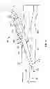 Fig. 02 - Anchor instrumentation and methods