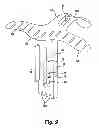 Fig. 10 - Method for controlling drug delivery through an infusion set