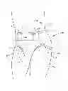 Fig. 01 - Insert with advantageous fastener configurations and end stiffness characteristics for two-piece wearable absorbent article