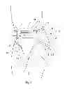 Fig. 02 - Insert with advantageous fastener configurations and end stiffness characteristics for two-piece wearable absorbent article