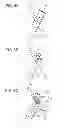 Fig. 07 - Catheter