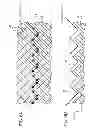 Fig. 09 - Catheter