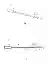 Fig. 02 - ELECTROMAGNETIC THERMOTHERAPY NEEDLE