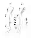 Fig. 33 - Microwave ablation catheter and method of utilizing the same