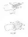 Fig. 03 - Multi-functional tissue manipulation medical device and related methods of use