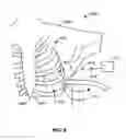 Fig. 07 - Apparatus and methods for facilitating treatment of tissue via improved delivery of energy based and non-energy based modalities