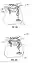 Fig. 08 - Apparatus and methods for facilitating treatment of tissue via improved delivery of energy based and non-energy based modalities