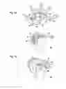 Fig. 10 - Equipment for inserting a joint prosthesis, in particular a knee prosthesis